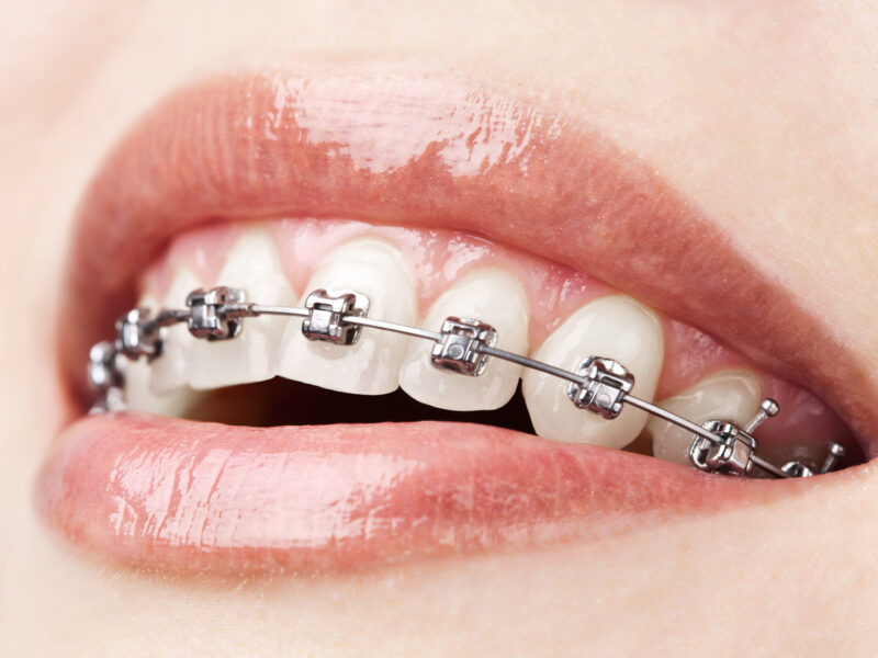 Dental Clinic Langwarrin