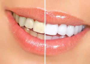 Dental Clinic Langwarrin